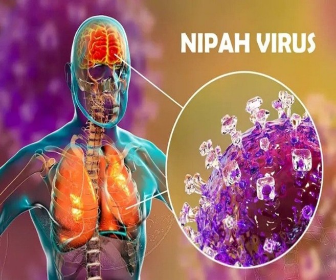 Dịch bệnh do Vi rút Nipah và khuyến cáo phòng, chống bệnh